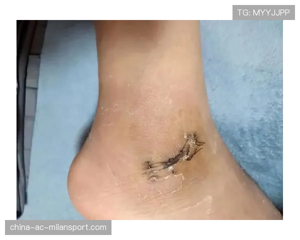 韧带手术后康复掰腿的痛苦嚎叫,韧带术后掰腿120能正常生活